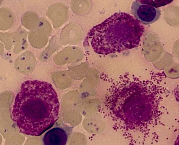 Hierarkiet for bloddannende celler Lymfatiske system Mastceller Myeloide system Kit: gen (DNA) som koder for eggehvitestoff c-kit på blodstamceller og mastceller 3 Paul Ehrlich