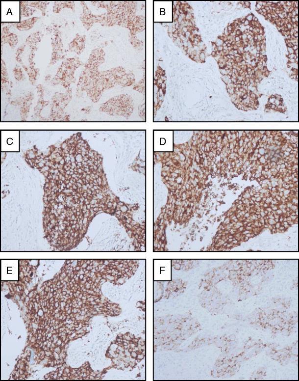 Formalinfiksering kan også påvirke immunhistokjemiske analyser: 3 t 8 t f.