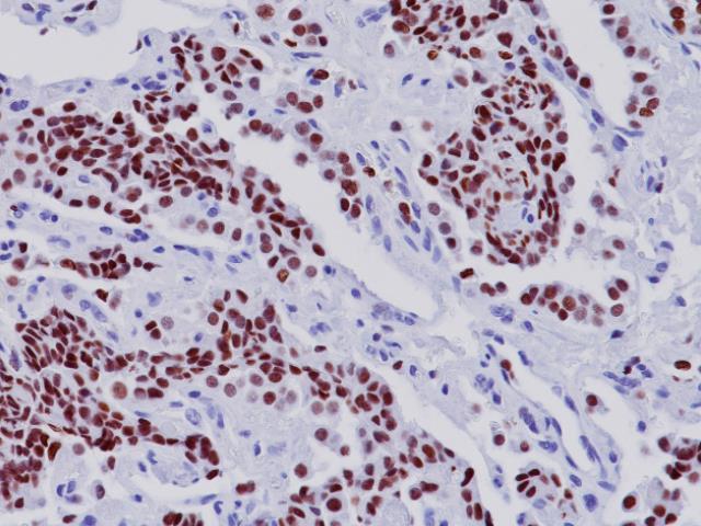 Tradisjonell diagnostikk Hematoxlin & Eosin