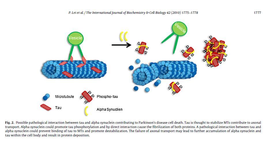 En patologisk binding mellom tau og alfa-synuklein kan