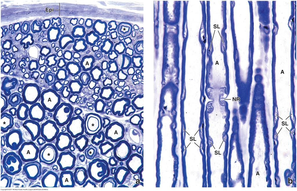 Perifer nerve Akson (A) Schmidt-Lantermanske incisurer (SL) Epineurium (Epi) Ranvierske