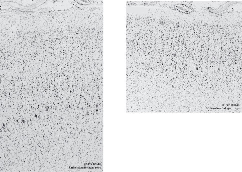 Laminae I - VI i neocortex Area 4 (MI) Area 3b (del