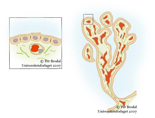 Plexus choroideus Endotelceller i kapillærer i plexus choroideus Bindevev Spesialiserte