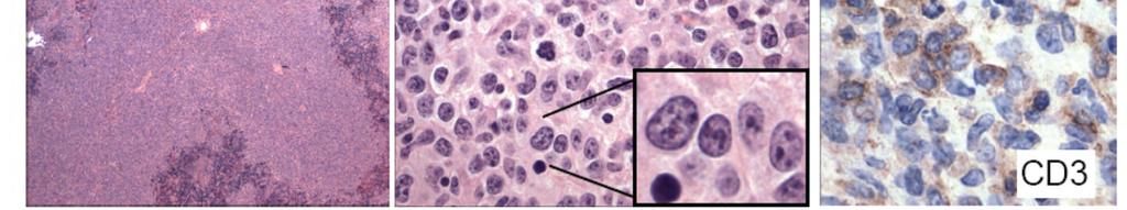 cytogenetically abnormal (copy