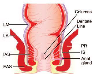 Man må kunne sin anatomi Halligan S et al.: Imaging of Fistula in ano.