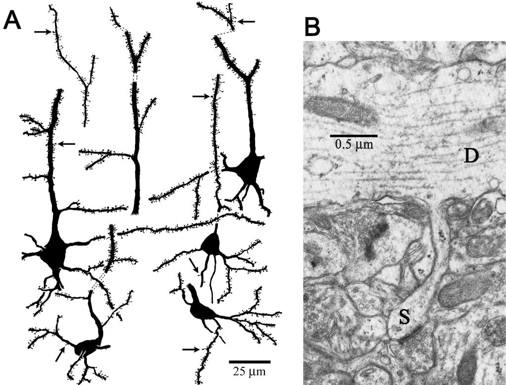 Dendrittiske spinae Copyright 2002, Elsevier Science