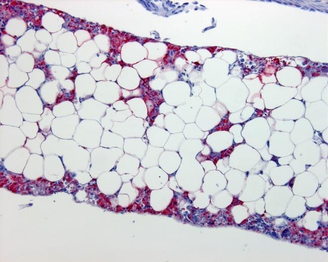 Yersinose, Flavobacteriose m fl Virussykdommer Laksepox, IPN,