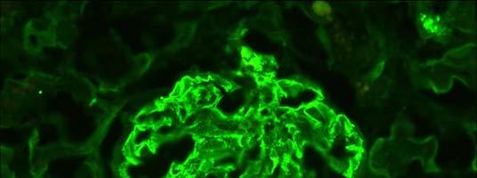 DIREKTE IMMUNFLUORESCENS Bilde