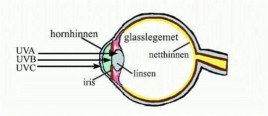 Inntrengning i øyet og mulige skader IR Virkninger på øyet: Synssansen Retinopati: