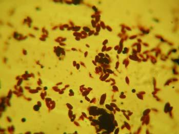 regala Colonii albe 1 Drojdii asporogene, roşii 2 Colonii galbene Bacterii, bacili scurţi (gram negativ) 3
