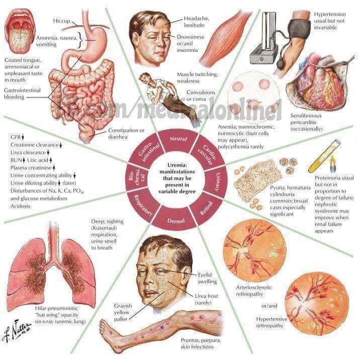 Symptomer ved