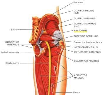 11. BMT og Piriformis syndrom M. Piriformis abdusere, ekstendere og lateralrotere hofteleddet. Nervus ischiadicus (kalt N. piriformis, og N. sciatic) kommer i press mellom M. piriformis og M.