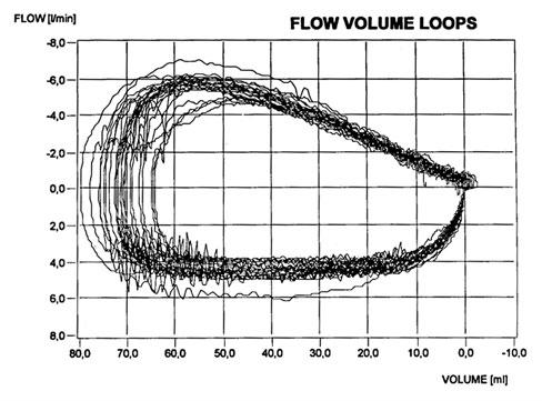 Interstitiell lungesykdom ukjent årsak Tideflow-volum-kurver: Hos yngre