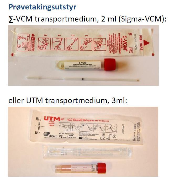 Prøvetaking luftvegsprøvar til PCR Copan UTM-RT kit eller Sigma-VCM Penslar og transportmedieum som er tilpassa genteknologiske analysar av mikrobar Kompatible med våre instrument Kan ikkje