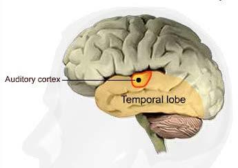 Fokale epilepsier Temporallappsepilepsi/TLE/ Hyppigst 50-60% av alle partielle epilepsier.