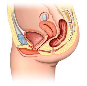 Kvinnens nedre urinveier 1. Livmor 2. Urinblære 3. Lukkemuskel 4.