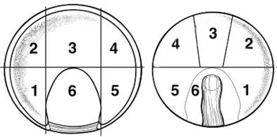 CALVÉ-LEGG-PERTHES - Registreres første gang ved diagnose/primærbehandling - Registreres ved senere behandling som krever anestesi CATTERALL: I/II III/IV 3.