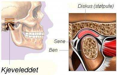 Del 5: Status presens Ekstraoralt Lymfeknuter: En palperer submandibulære, submentale og cervicale lymfeknuter. Er det hevelse og eller ømhet bemerker en dette.