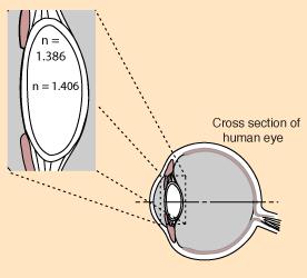 Øyets linsesystem Øyets linsesystem fokuserer lyset. Fokallengde, f 1.5 cm.
