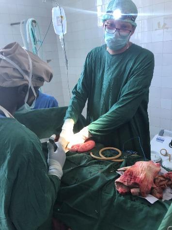 Hydatid cyste kirurgi Nyhetsbrev fra Addis Abeba 2.