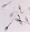 april 2018 1968 In vitro fertilisering av humant oocytt Edwards RG et