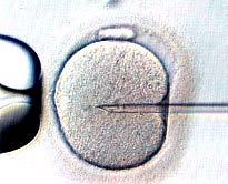 embryo is created by adding the parents' pronuclei to the donor embryo, which is finally implanted into the womb Metoden brukes til å endre DNA ved å benytte seg av et enzym (Cas9) som kutter et