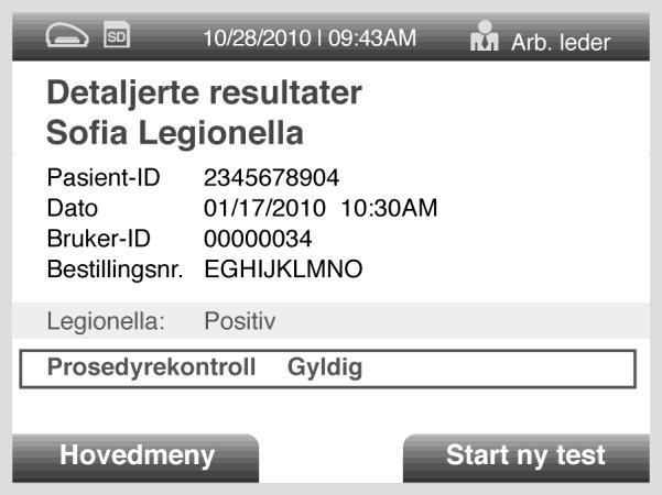 TOLKNING AV RESULTATER Når testen er fullført, vises resultatene på Sofia-skjermen. Resultatene kan også skrives ut automatisk på den integrerte skriveren hvis dette alternativet er valgt.