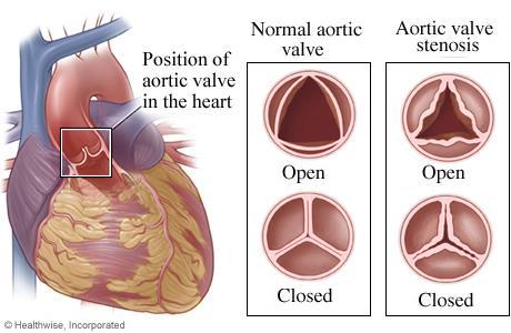 Aorta