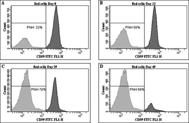 Eculizumab effekt på PNH