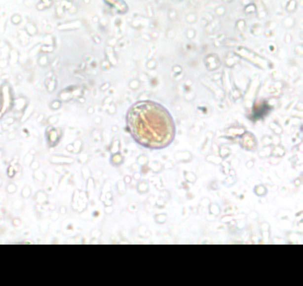 Parasitt påvirkninger hos mennesker?? Giardia spp. og Cryptosporidium spp. Encellede parasitt/protozoa Zoonotisk!