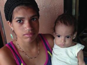 Hun har ikke brystmelk, og sønnen Michael på elleve måneder risikerer å dø av underernæring. Akutt underernæring hos barn under fem år i Venezuela er tredoblet de to siste årene.