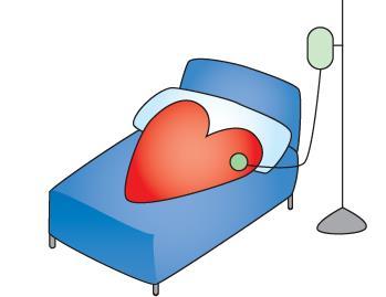 Utvikling av hjertesvikt sykdom/overbelastning av hjertet Eks: hjerteinfarkt, hypertensjon, klaffefeil, rytmeforstyrrelser etc.