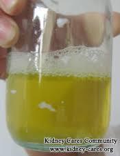 Proteinuri protein i urinen ut over det som er normalt (normalt 30-50 mg/døgn) Klassifisering av proteinuri