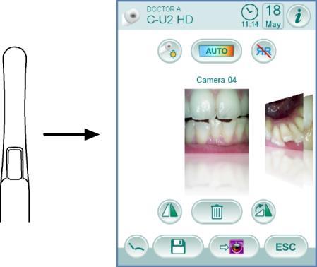 5.8. INTRAORALT KAMERA C-U2 C-U2 er et spesielt utformet intraoralt kamera for enkel bruk i forbindelse med intraoral dental undersøkelse.