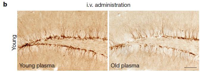 Eldre mus påvirker yngre mus negativt Stoffer i blodet til eldre mus hemmer vekst av