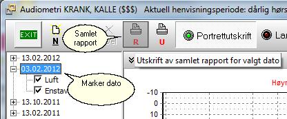 For å skrive ut en samlet Audiogram for hele dagen marker vi