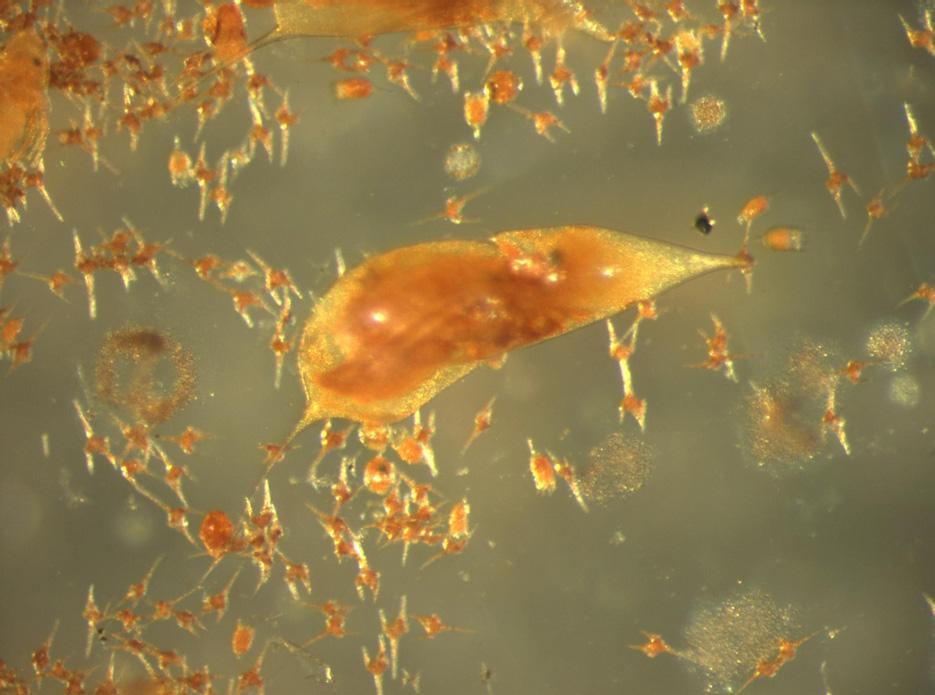 Dyreplankton Dyreplanktonet i Stavsjøen hadde en sammensetning som er karakteristisk for middels næringsrike og næringsrike innsjøer (se artsliste i vedlegget).