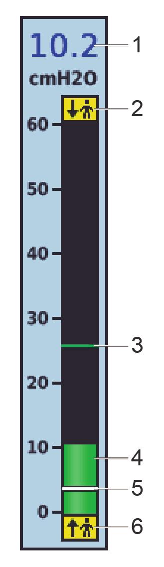 NORSK 11 Beskrivelse 1 Verdi for peak-inspirasjonstrykk (PIP) 2 Markør for spontan-cyclet respirasjon indikerer pasientcyclet respirasjon 3 Markør for