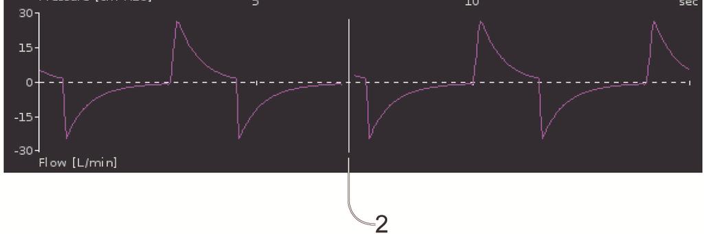 15 sekundene av pasientens luftveistrykk og -flow i et diagram. Diagrammet oppdateres i sanntid.