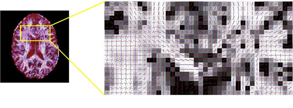 4.8 Detaljer om de benyttede funksjonene i FSL 5 Figur 4.7: Visualisering av to fiberpopulasjoner per voksel med terskelverdi f2 =0.