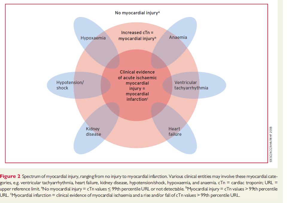 Myocardial injury -