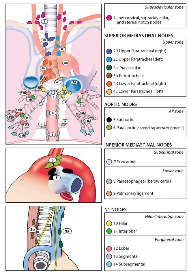 Vedlegg 1 TNM atlas Lungekreft