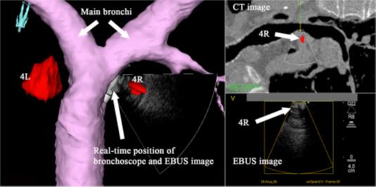 På denne måten får kirurgen tredimensjonale og mer detaljerte bilder å navigere etter, i tillegg til at man reduserer bruken av røntgenstråling på operasjonsstua.