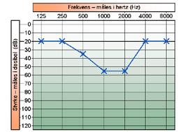 En som har et høreapparat har det på grunn av et hørselstap, og det er svært sjelden lineært, og det er ganske vanlig at en høreapparatbruker ikke hører alle frekvenser og nyttigjør seg forskjellige