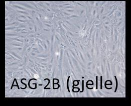 Figur 4. Bilder av cellekulturer fra 3 av ulike organer som er etablert i prosjektet.