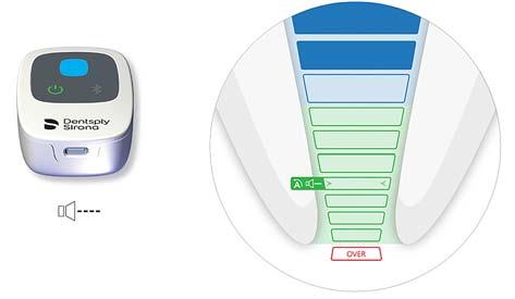 6.7.7 Bestemme arbeidslengde Ikke start en behandling hvis batterinivået er lavt. Progresjonen til den endodontiske filen vises på lysdioden midt på Propex IQ apekslokator.