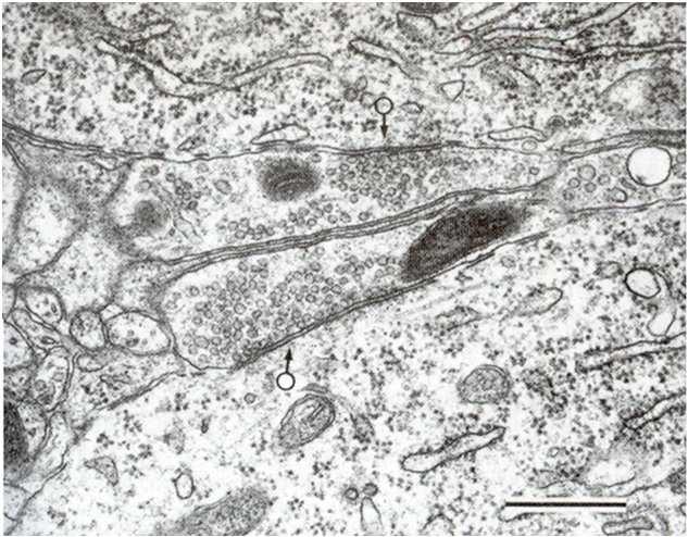 GABA synapse Nerveterminal Postsynaptisk membran (uten postsynaptisk fortettning) 37 GABA: funksjon & klinikk Funksjon Hovedsystem for presis hemming (IPSP).