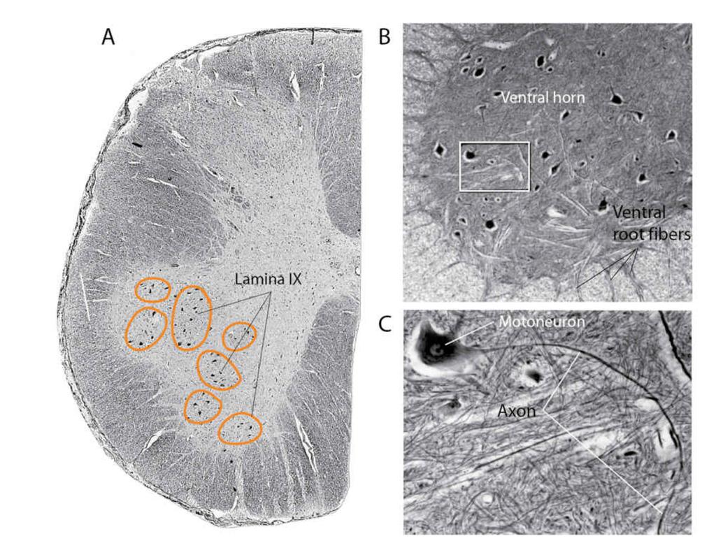 Motonevroner Aksonene fra motonevronene (ventralrotsfibrene) er farge mørke (i liket med soma) og danner bunter som går gjennom