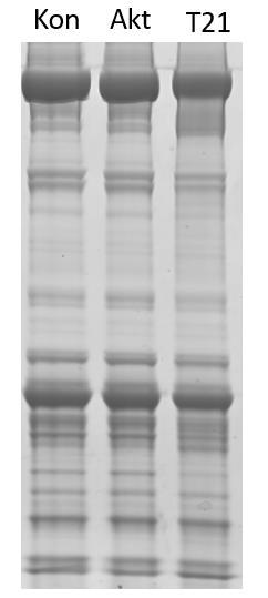 Figur 17: 1D-SDS-PAGE. Ett representativt 1D-SDS-PAGE av proteiner ekstrahert fra muskelprøver behandlet med ulike enzymer.