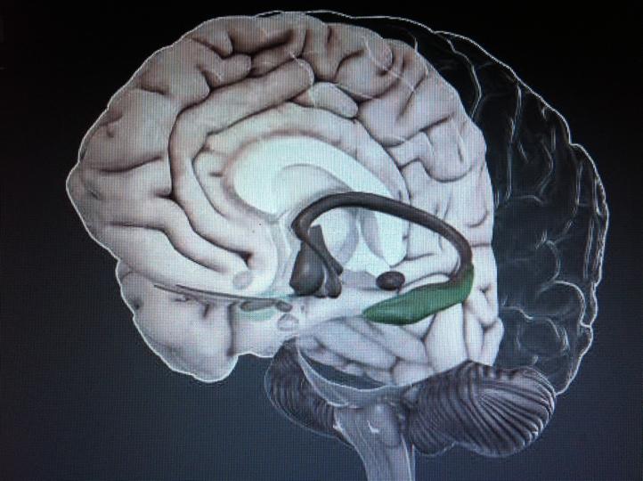 delene av hjernen har.